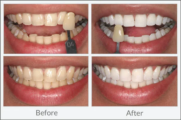 32331 regular dental checkups