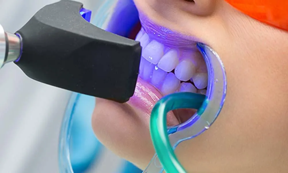32331 whitening friendly toothpaste