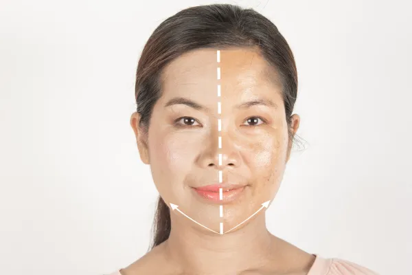 32333 facial whitening glow before after