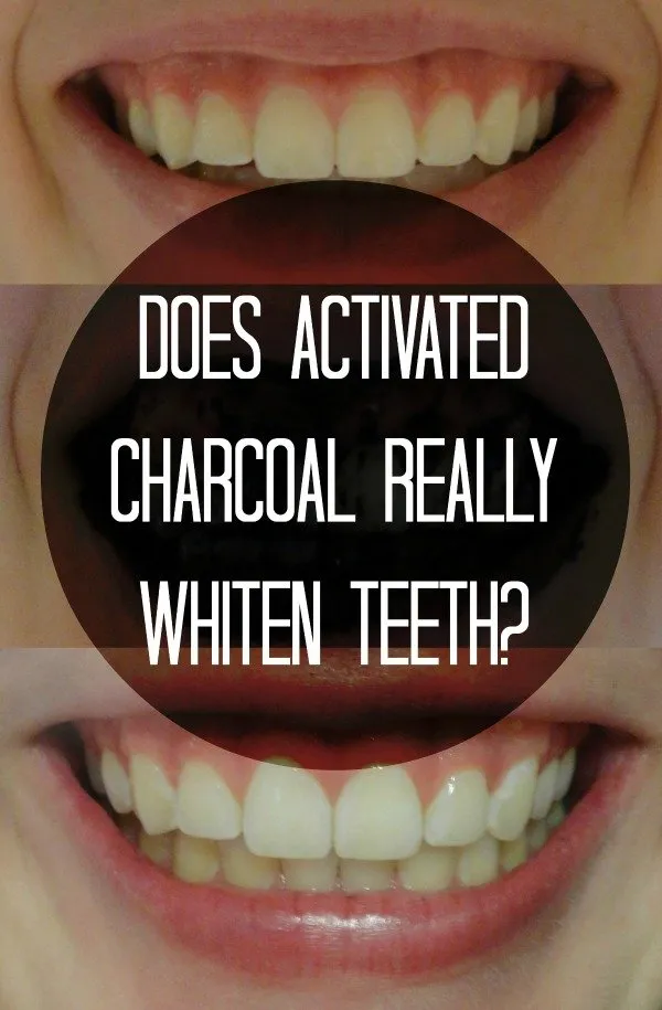 32335 charcoal teeth whitening smile