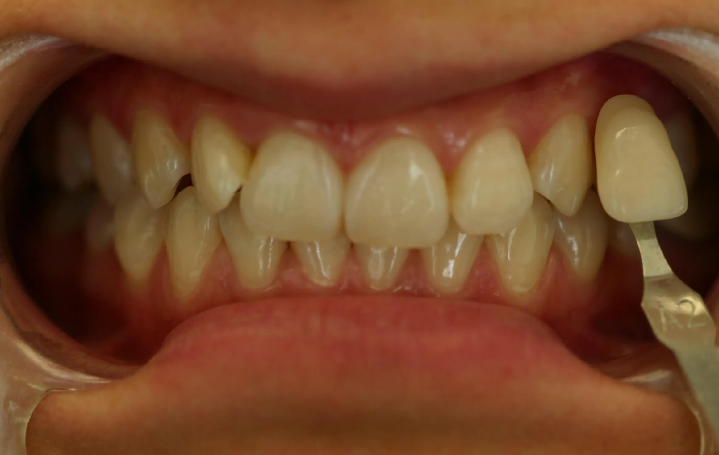 /img/32337-dental-consultation.webp