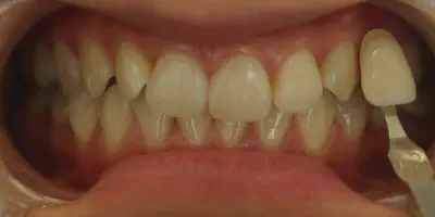/img/32337-dental-consultation.webp