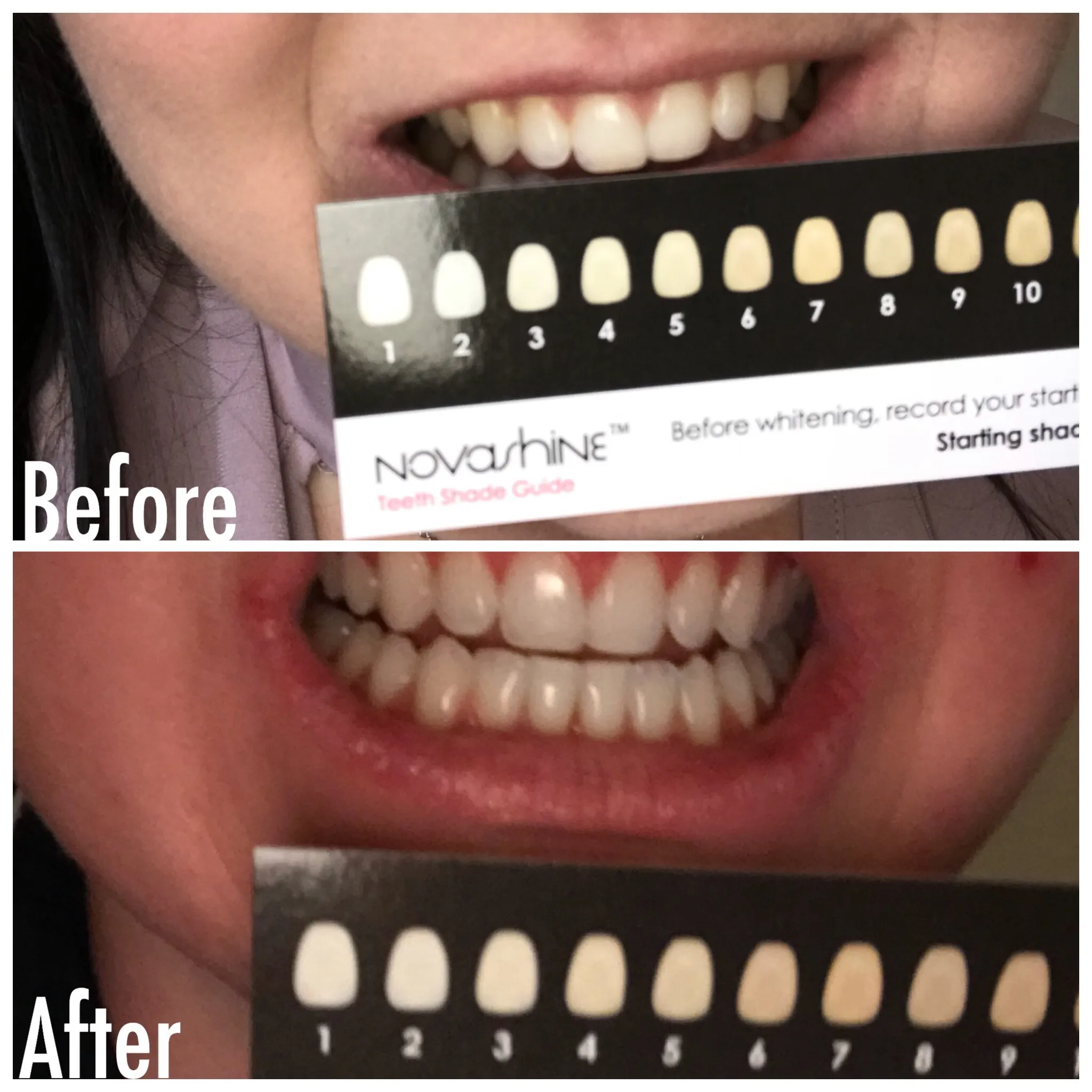 32339 maintaining white smile