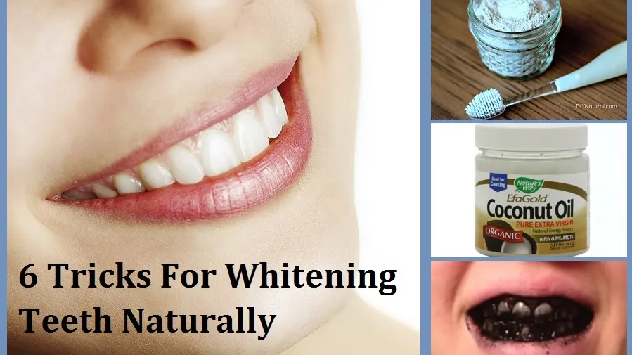 32342 teeth whitening basics