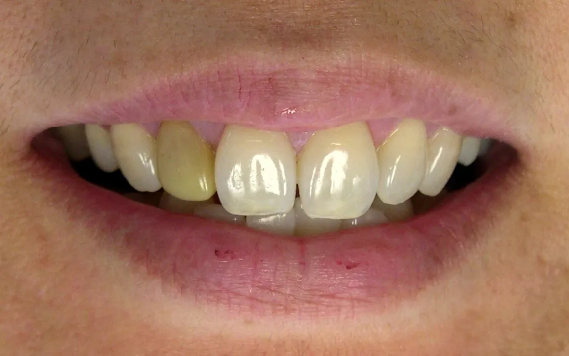 /img/32345-dentist-teeth-whitening.webp