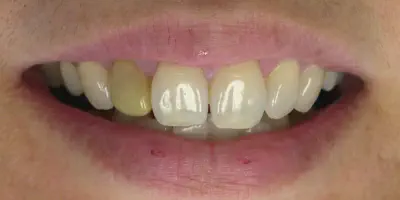/img/32345-dentist-teeth-whitening.webp