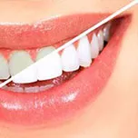 32348 teeth whitening dothan al image3