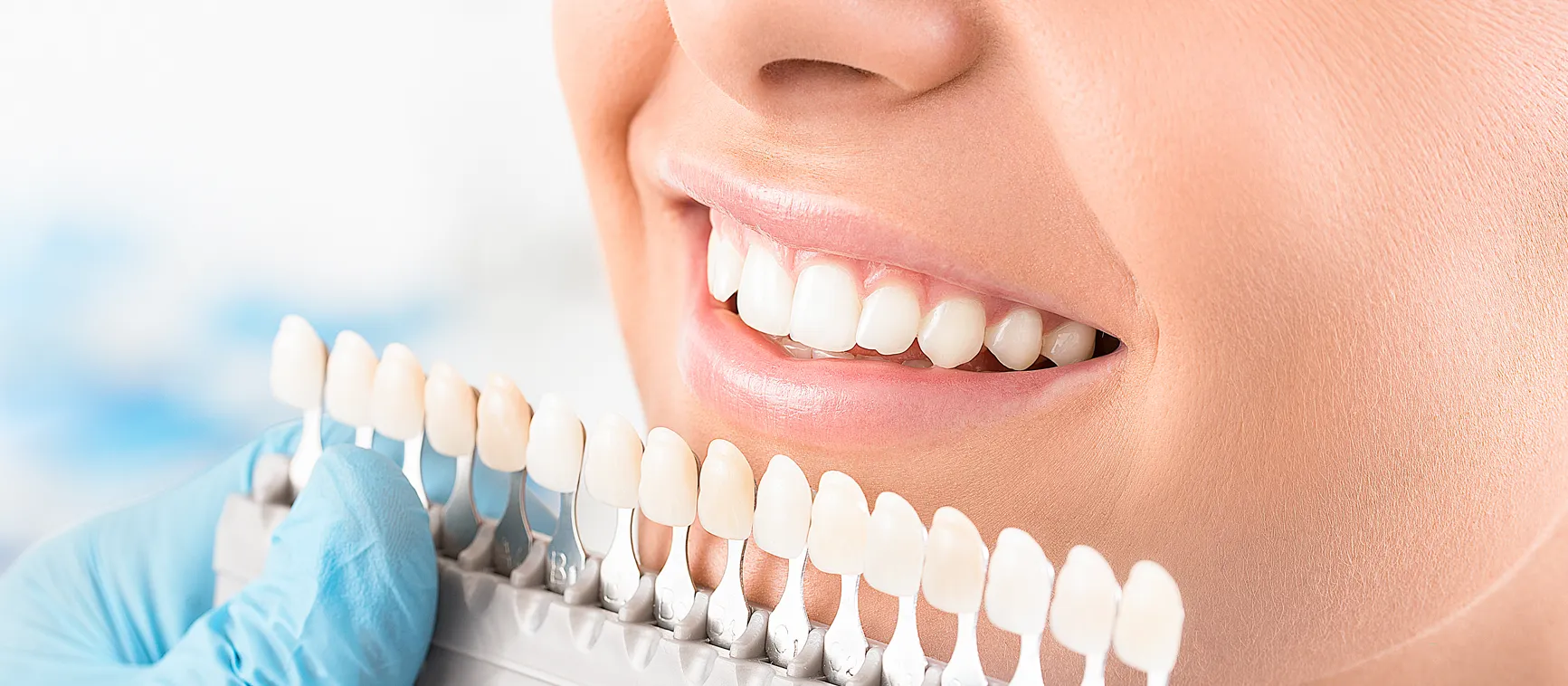 32348 teeth whitening dothan al image6