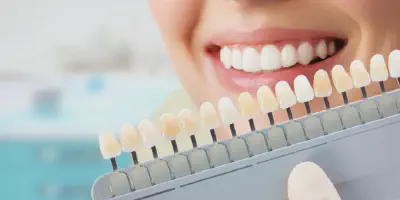 /img/32352-happy-patient-teeth-whitening.webp