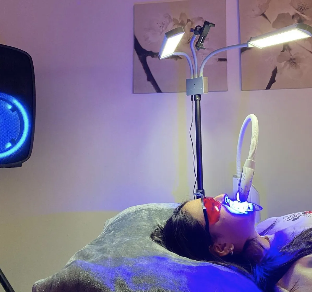 32352 in office teeth whitening