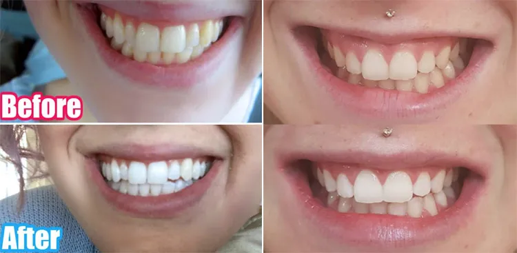 32354 dentist visit