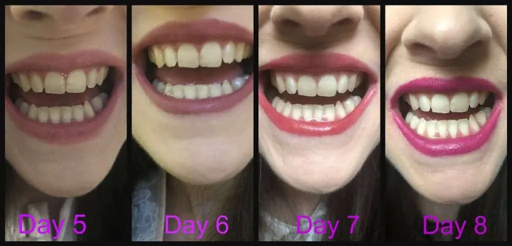 32354 oral hygiene