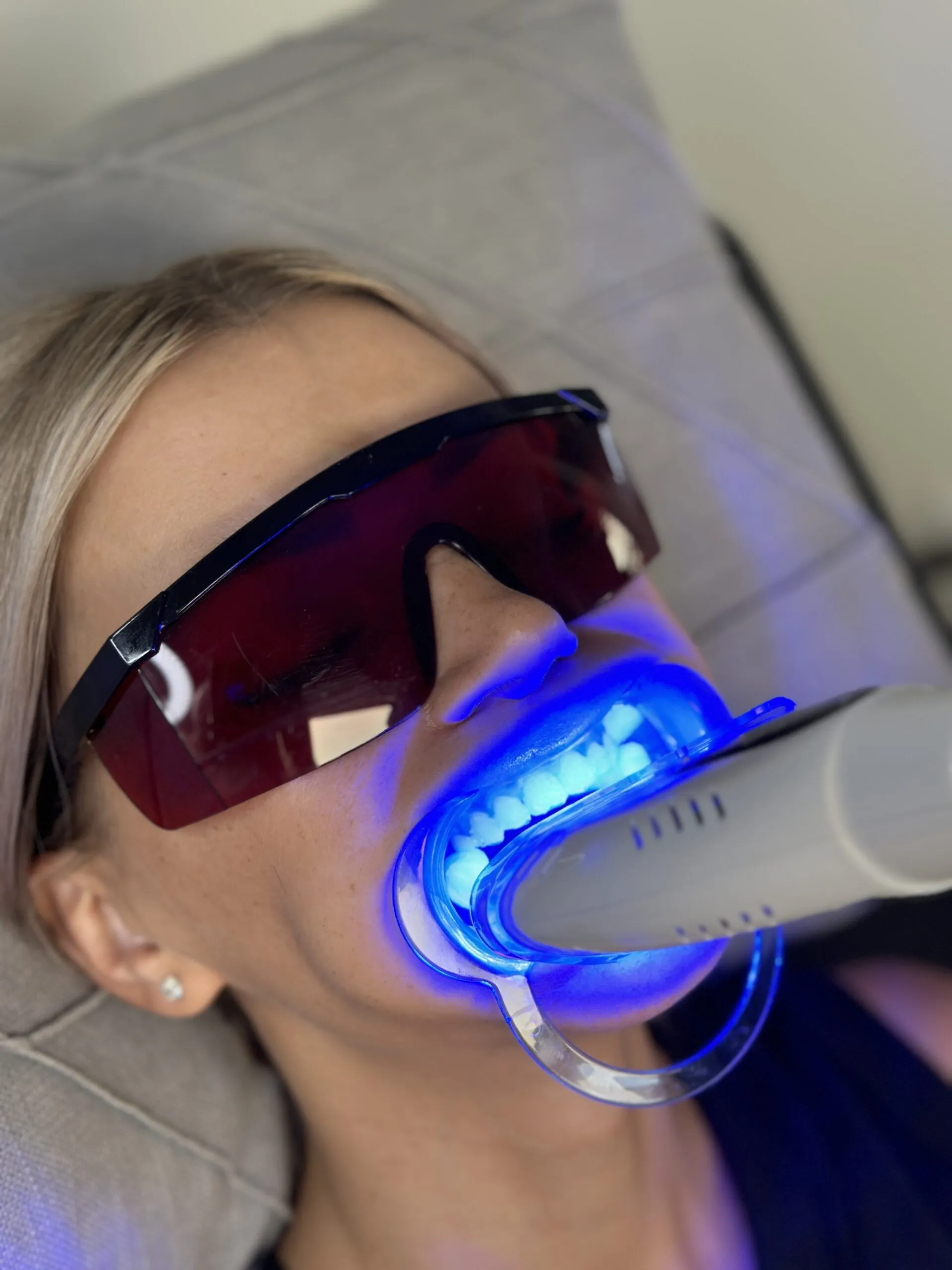 32356 teeth whitening toothpaste