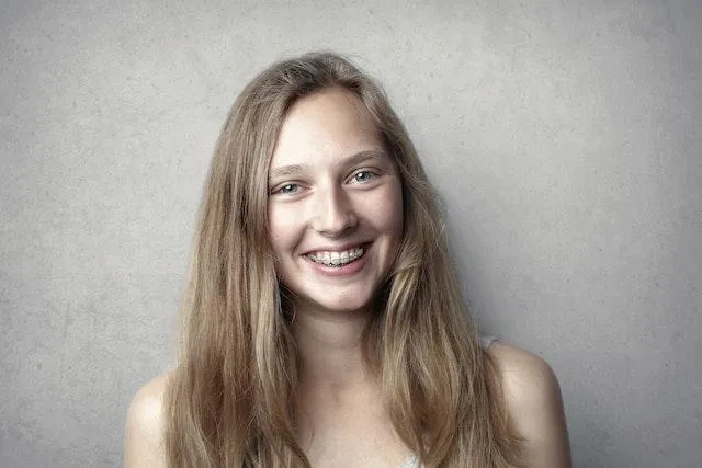 /img/32358-teeth-whitening-after-braces-image7.webp