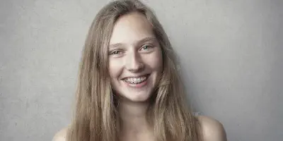 /img/32358-teeth-whitening-after-braces-image7.webp