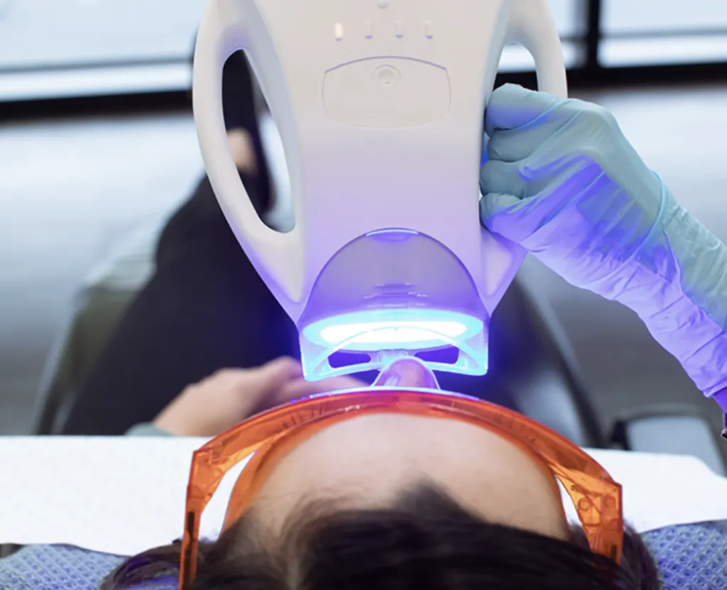 32359 invisalign teeth whitening