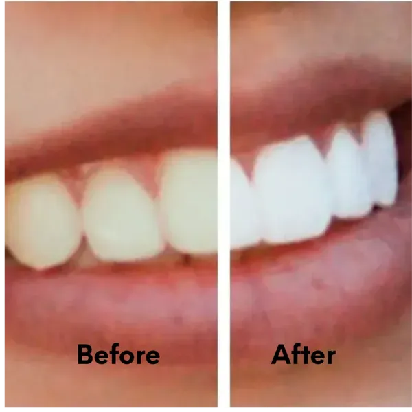 32360 teeth whitening portland toothpaste