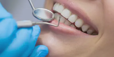 /img/32365-healthy-teeth-8.webp