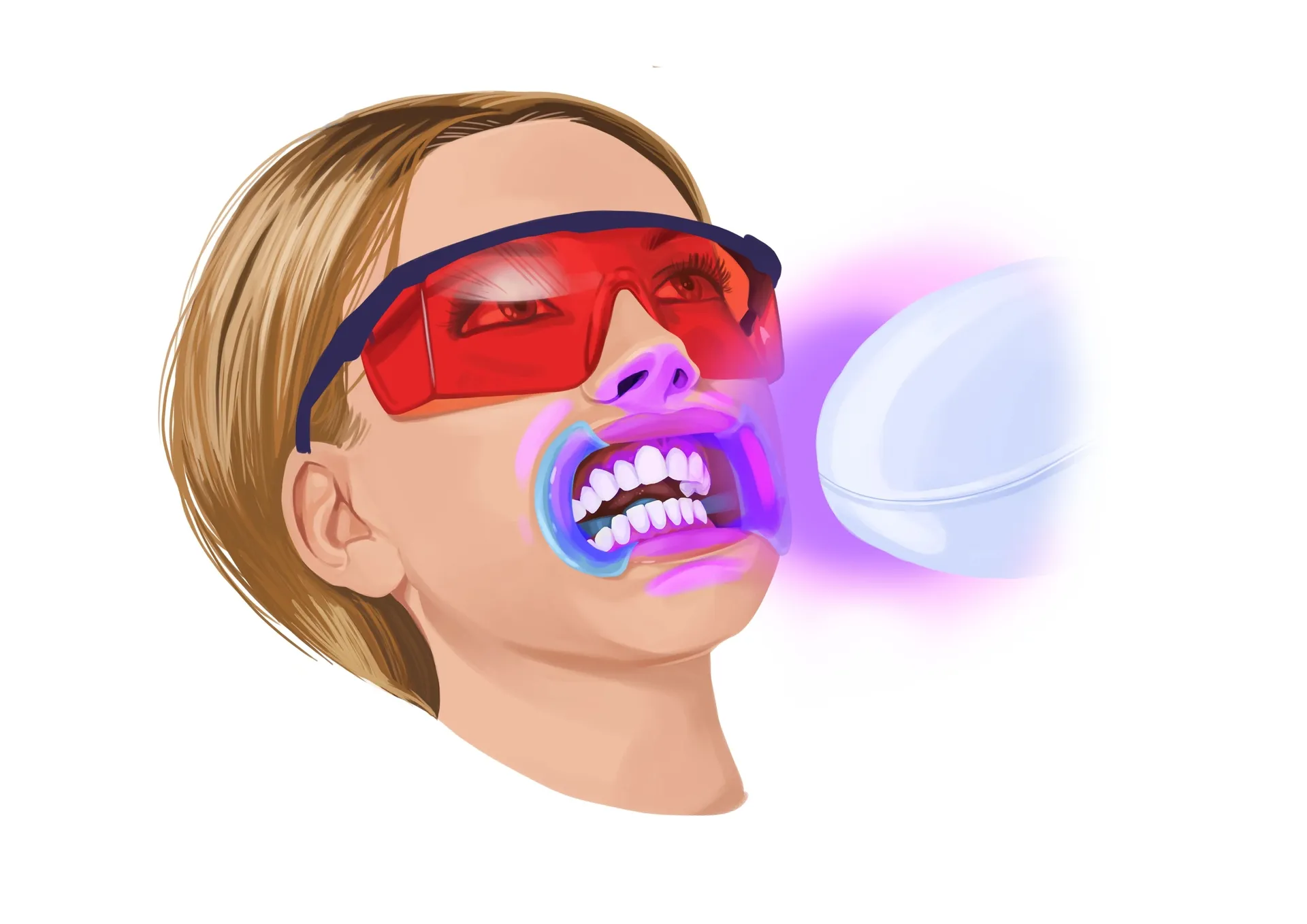 32366 in office teeth whitening