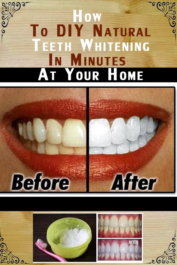 /img/32367-healthy-smile.webp