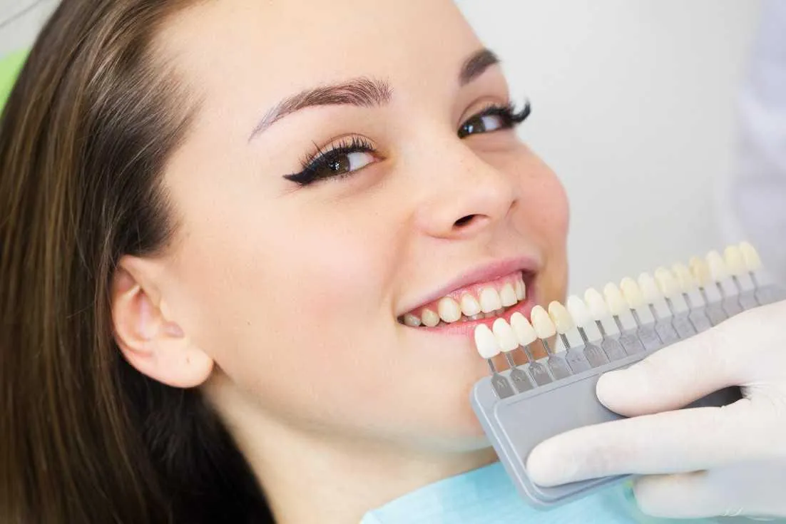32371 teeth whitening before after