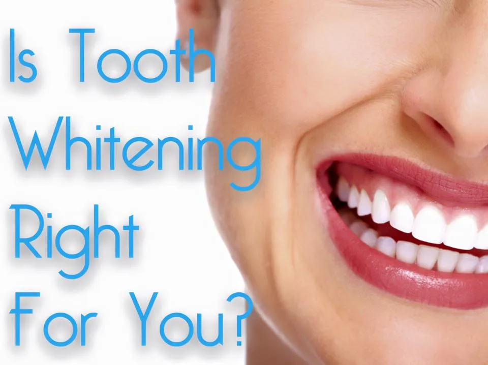 32372 whitening net user interface
