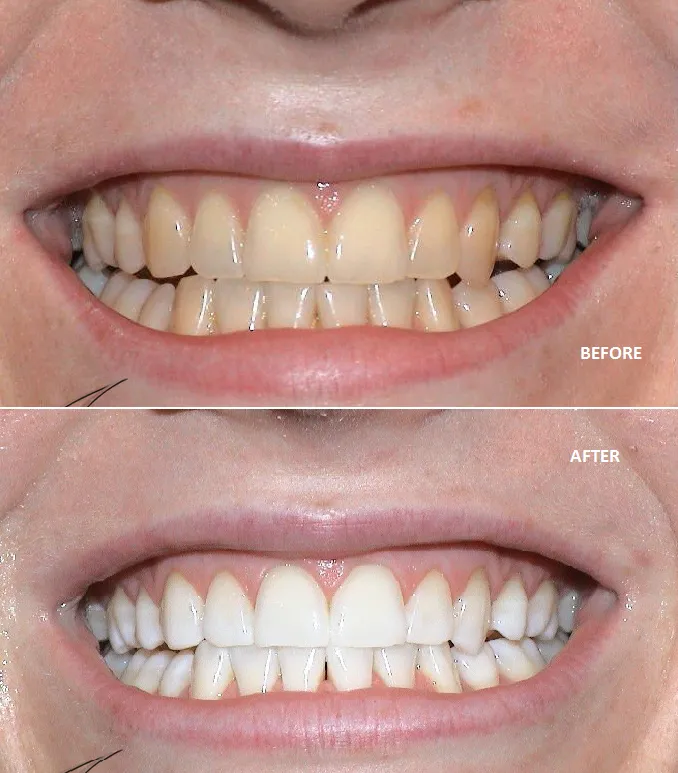 32375 choosing a dentist northern ireland