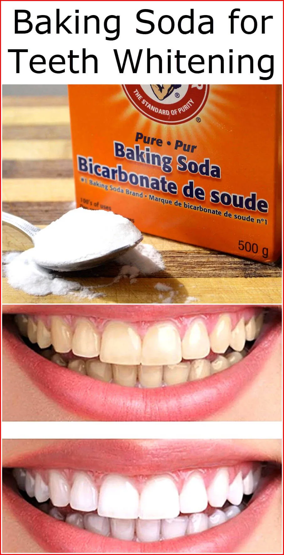 32376 ginger and baking soda teeth whitening
