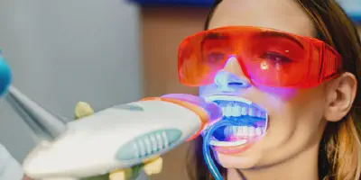 /img/32377-consulting-dentist-teeth-whitening.webp