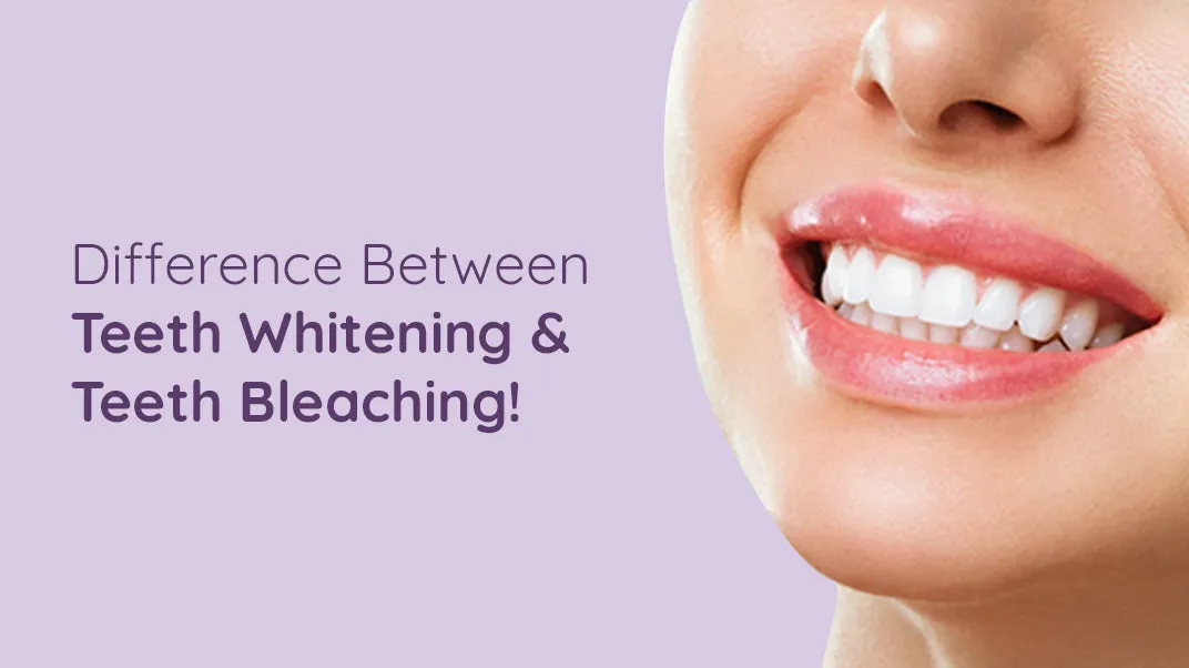 32377 effectiveness teeth whitening bleaching