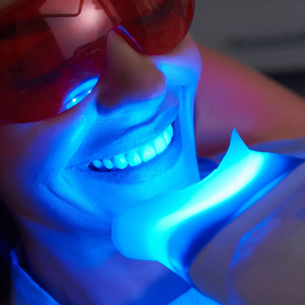 32377 professional teeth whitening