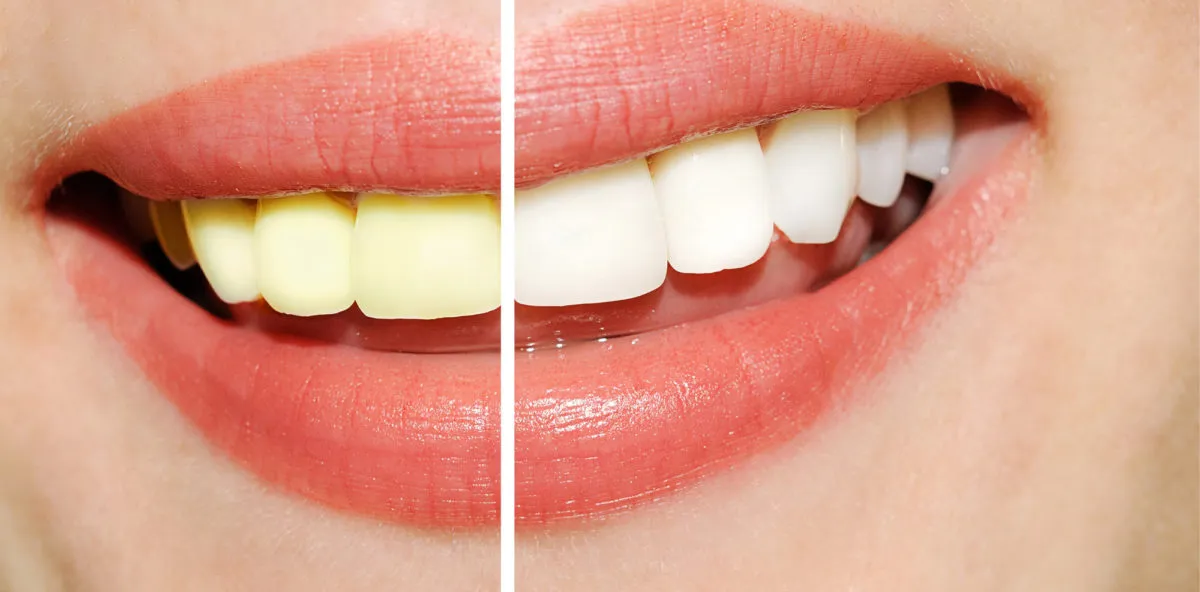 32380 healthy diet teeth