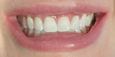 /img/32382-dental-alternatives.webp