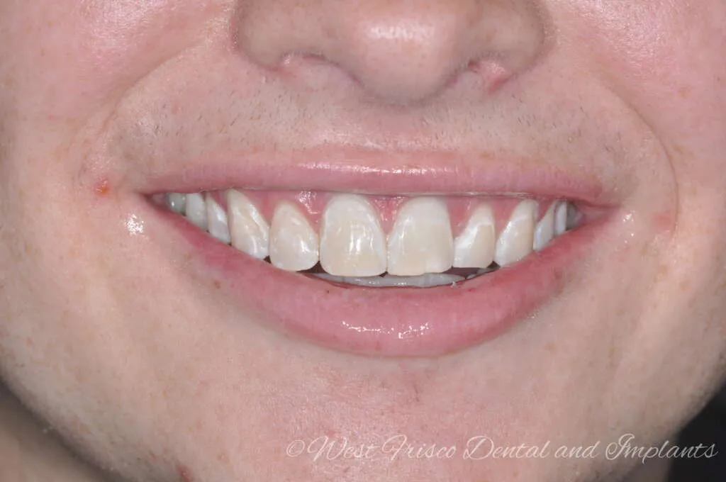 32382 dental checkup