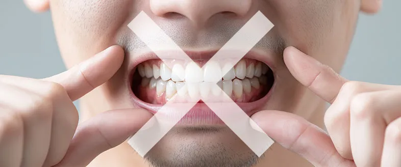 32384 sensitive teeth image2